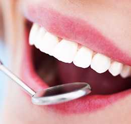 periodontics image tile