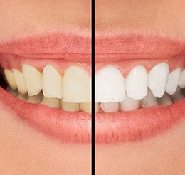 prosthodontics tile image